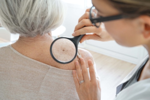 Senior,Woman,Getting,Skin,Checked,By,Dermatologist
